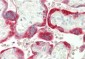 CGB / hCG Beta Antibody (Beta 2, clone INN-hCG-22)